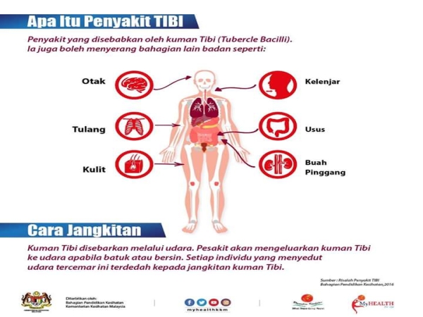 Apa Itu Penyakit Tibi?