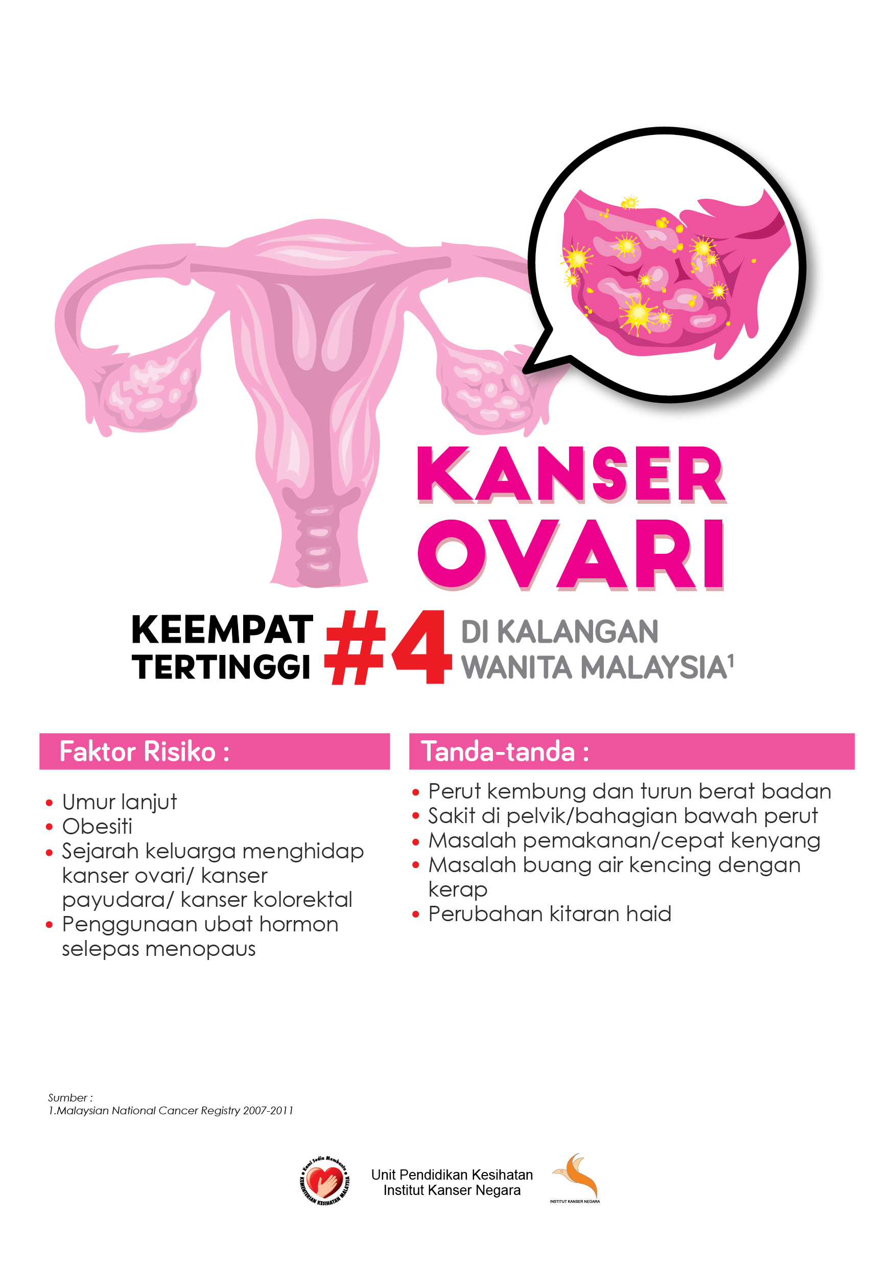 Poster A2 kanser ovari 01
