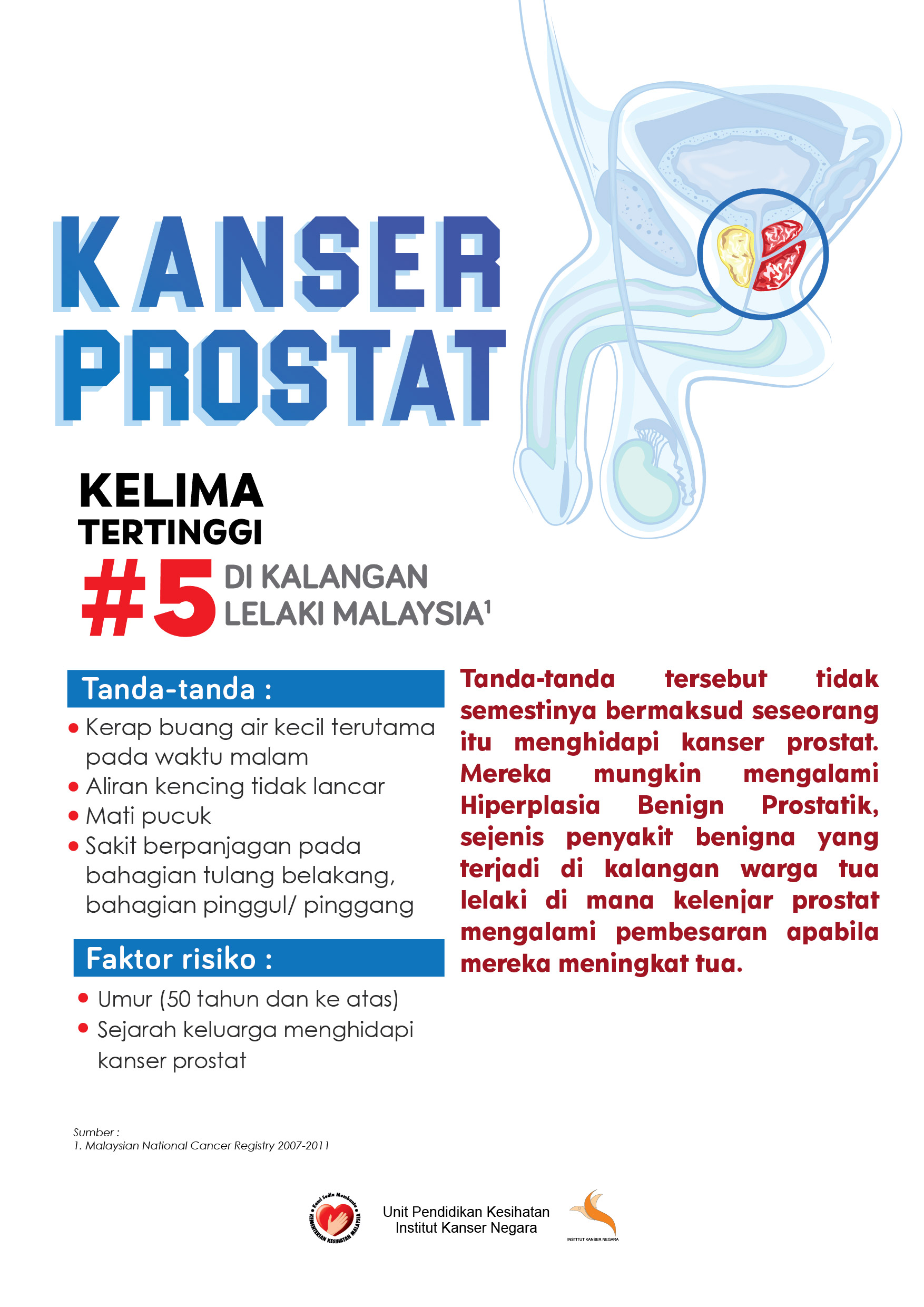 Poster A2 kanser prostat 01